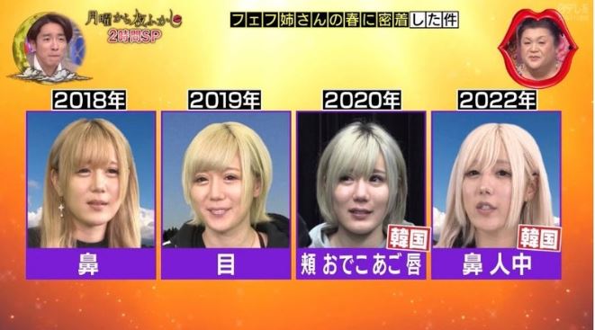 【真相】 多田 さん 整形 前 気になる噂と真相 #887