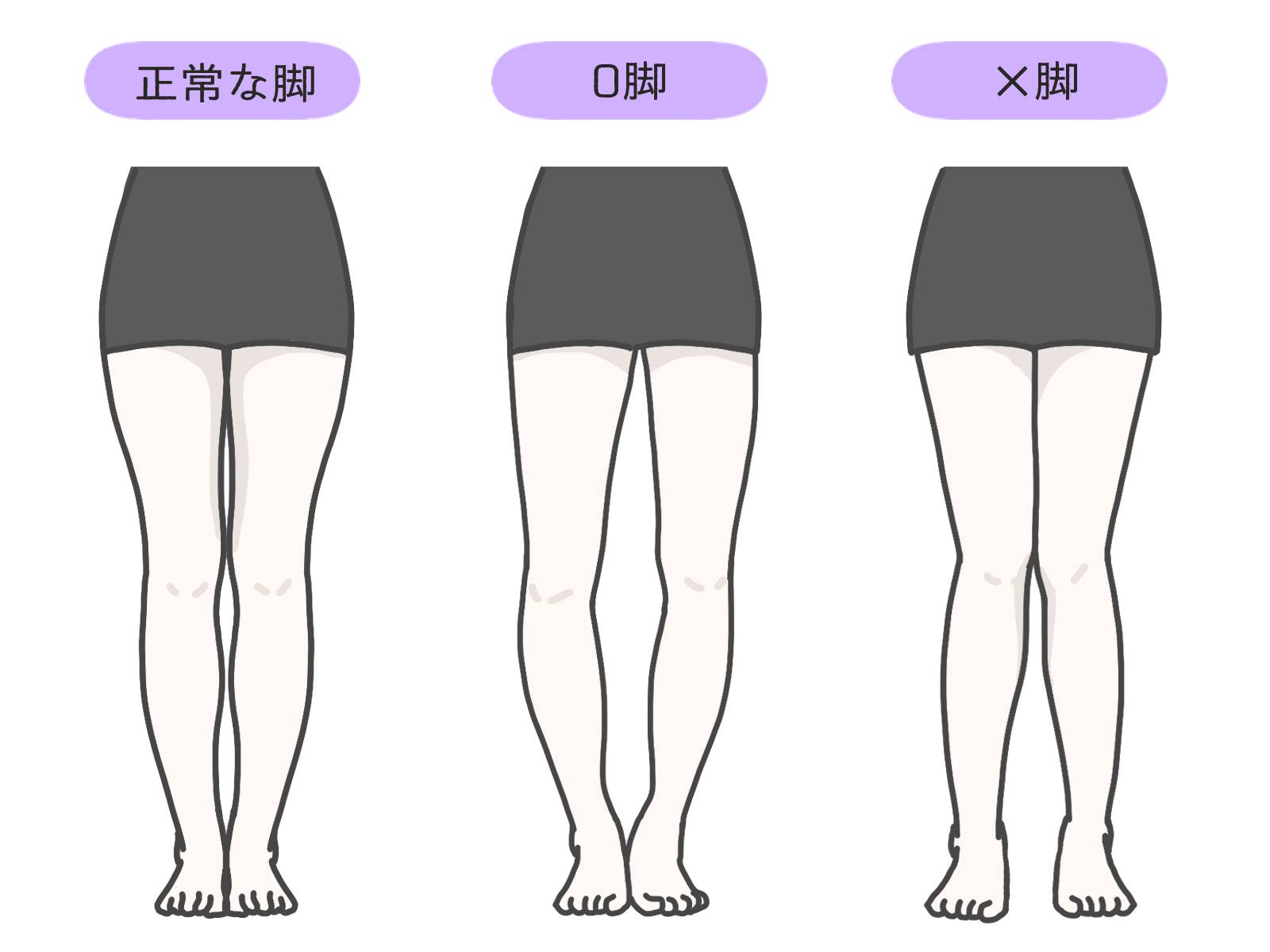 歪んだO脚を毎日3分でリセット！プロが明かす美脚習慣の秘密